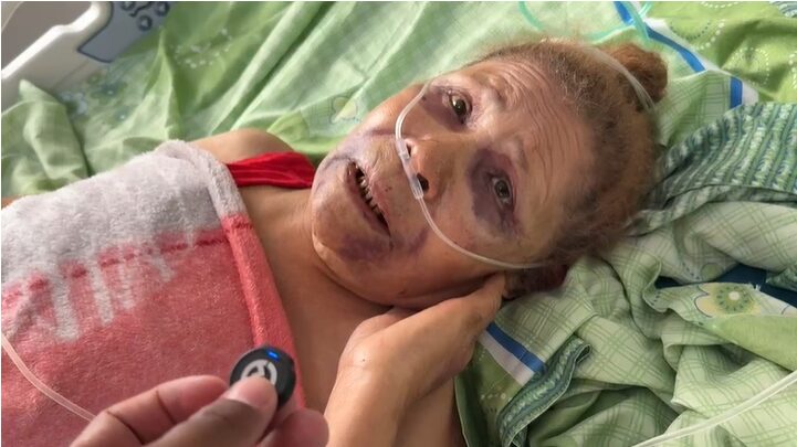Anciana de 86 años es golpeada por varios haitianos y le prenden fuego a su vivienda en Cuaba Arriba, SFM