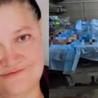 Fallece mujer de 55 años tras ataque de perros pitbull en Honduras