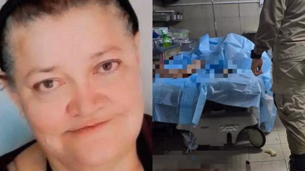 Fallece mujer de 55 años tras ataque de perros pitbull en Honduras