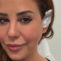 Myrka Dellanos revela que fue diagnosticada con cáncer de piel