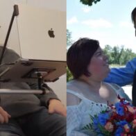 Un hombre pudo decirle “te amo” a su esposa gracias a un implante cerebral de Neuralink