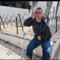 Accidente cambió su vida: joven pide ayuda para férula, terapias y medicamentos para crisis epiléptica