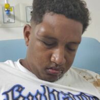 Autoridades buscan familiares de hombre ingresado en hospital Teófilo Hernández en El Seibo