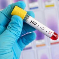 El Salvador registra 229 casos nuevos de VIH en el primer trimestre de 2026: el 85 % afecta a hombres