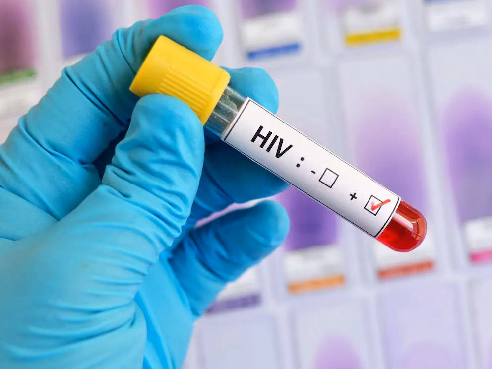 El Salvador registra 229 casos nuevos de VIH en el primer trimestre de 2026: el 85 % afecta a hombres