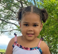 Madre pide ayuda urgente para salvar la vida de su hija de dos años con quistes cerebrales