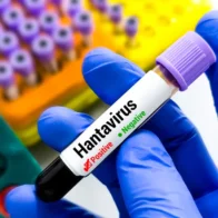 Confirman muerte por hantavirus en Colorado; autoridades investigan el caso