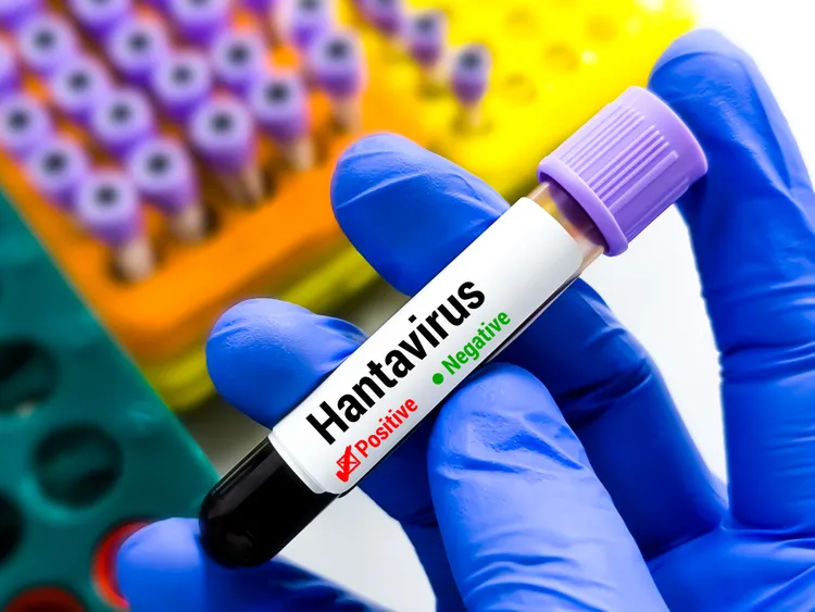 Confirman muerte por hantavirus en Colorado; autoridades investigan el caso