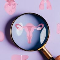 Cambian el nombre del síndrome de ovario poliquístico (SOP) a síndrome ovárico metabólico poliendocrino (PMOS) 