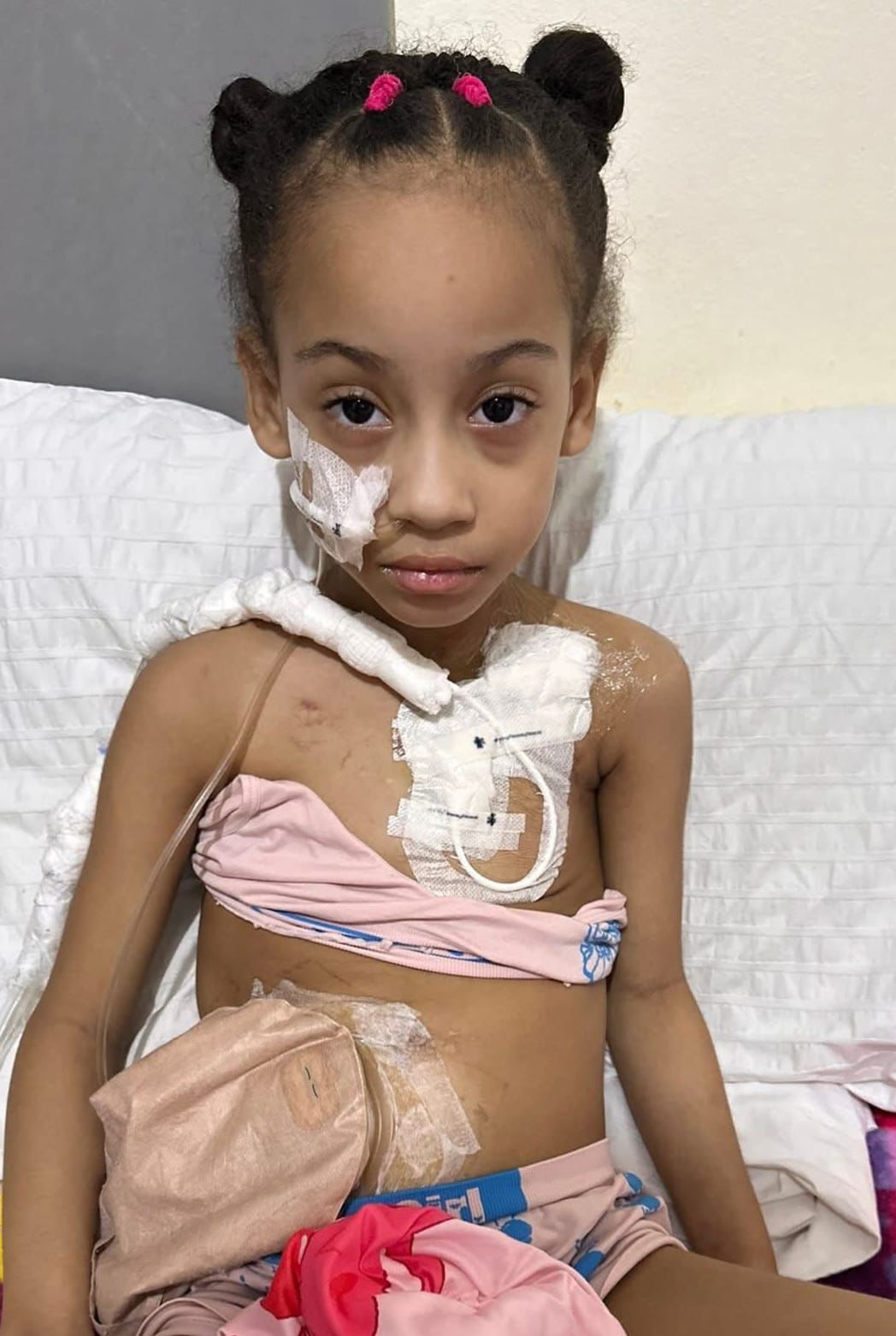 Ana Victoria López, niña de 5 años de Las Terrenas, lucha contra rara enfermedad y requiere traslado médico urgente