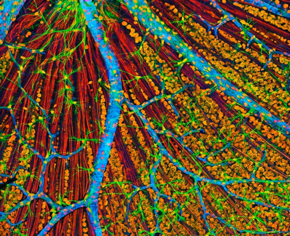 La primera terapia genética para rejuvenecer células humanas inicia pruebas en pacientes con glaucoma