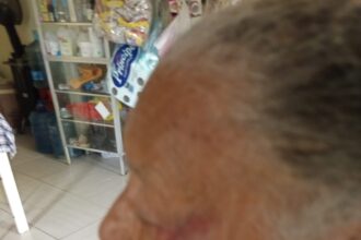Adulta mayor de 84 años denuncia agresión por parte de hijo de crianza