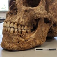 Identifican en Israel la herida por violencia más antigua conocida en una mandíbula de 90.000 años