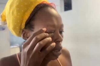 Hombre agrede a su expareja haitiana y le provoca lesiones en el rostro en San Francisco de Macorís