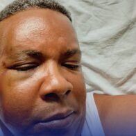 Inspector del COBA termina hospitalizado tras agresión durante operativo por música alta en SDE
