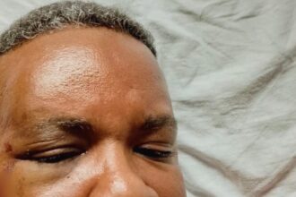 Inspector del COBA termina hospitalizado tras agresión durante operativo por música alta en SDE