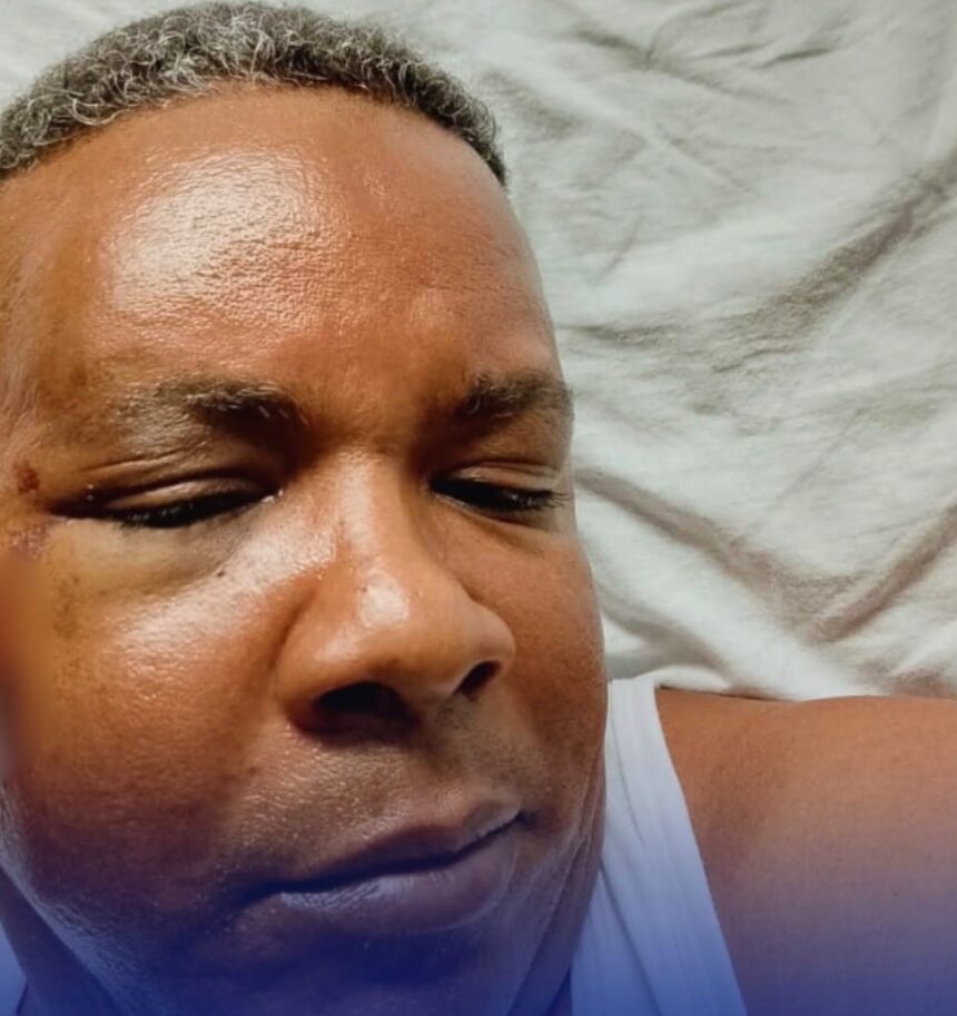 Inspector del COBA termina hospitalizado tras agresión durante operativo por música alta en SDE