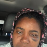 Maestra denuncia que ella, su esposo y su hijo de 15 años fueron agredidos a batazos por una pareja en Higüey