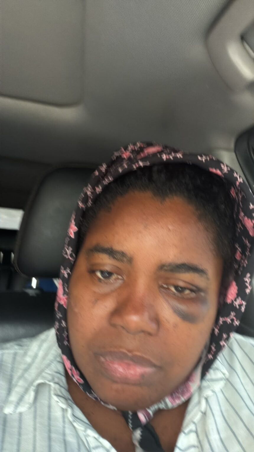 Maestra denuncia que ella, su esposo y su hijo de 15 años fueron agredidos a batazos por una pareja en Higüey