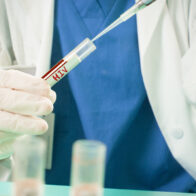 Uruguay registró 739 diagnósticos de infección por VIH en 2025, 93 menos que en 2024