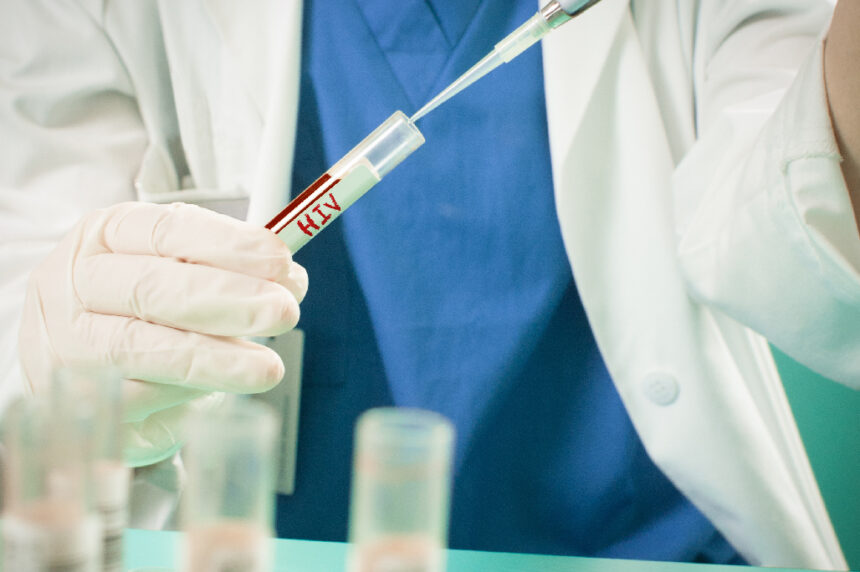 Uruguay registró 739 diagnósticos de infección por VIH en 2025, 93 menos que en 2024