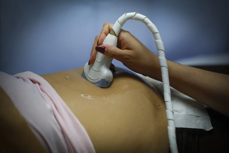 Ultraderecha chilena busca obligar a las mujeres a oír el latido del feto antes de abortar