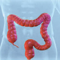 Cáncer colorrectal aumenta entre menores de 50 años; especialistas llaman a reforzar la prevención