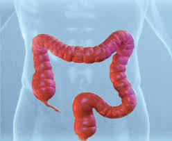 Cáncer colorrectal aumenta entre menores de 50 años; especialistas llaman a reforzar la prevención