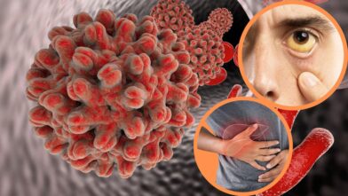 Costa Rica confirma 14 casos de hepatitis A y contaminación en sistema de agua