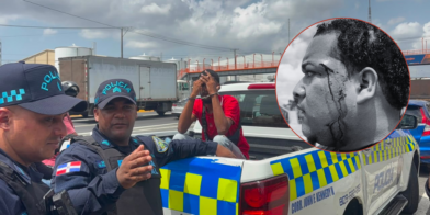 Agreden a camarógrafo de De Último Minuto mientras cubría accidente en la avenida Kennedy