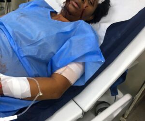 Mujer permanece hospitalizada tras presunta agresión en Los Alcarrizos