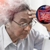 ¿Puede el intestino influir en el Alzheimer? Un estudio busca la respuesta