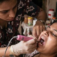 Familia denuncia que atendió urgencia dental con máquina de uñas ante crisis de salud Cuba