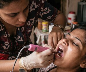 Familia denuncia que atendió urgencia dental con máquina de uñas ante crisis de salud Cuba
