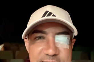Marcos Yaroide revela que fue operado de emergencia por desprendimiento de retina