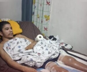 Familiares solicitan ayuda para joven de 30 años con enfermedad poco frecuente