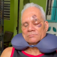 Ángel Castillo.