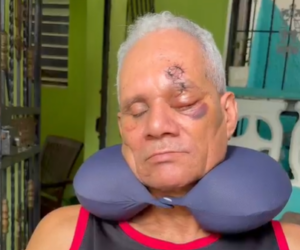 Hombre pierde ojo por agresión de jóvenes a botellazos; pide sean apresados