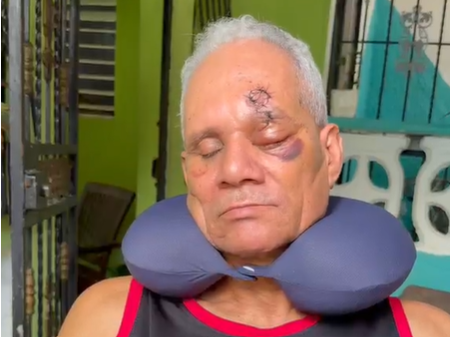 Ángel Castillo.