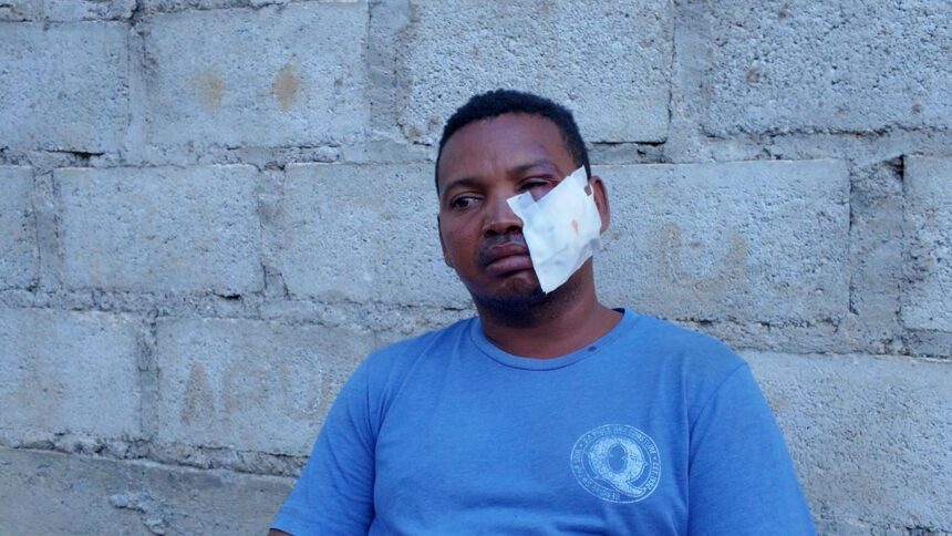 “Que se haga justicia”: padrastro de niño atropellado en Brisas del Este relata cómo ocurrió la tragedia