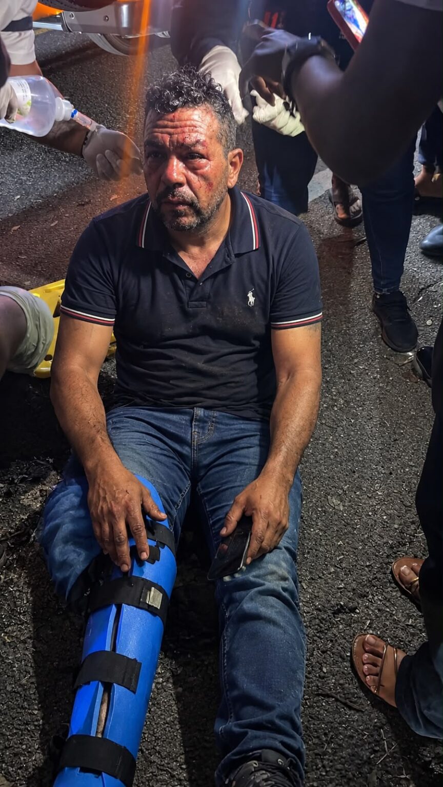 Accidente en Salcedo deja un hombre herido con fracturas en ambas piernas