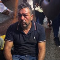Accidente en Salcedo deja un hombre herido con fracturas en ambas piernas