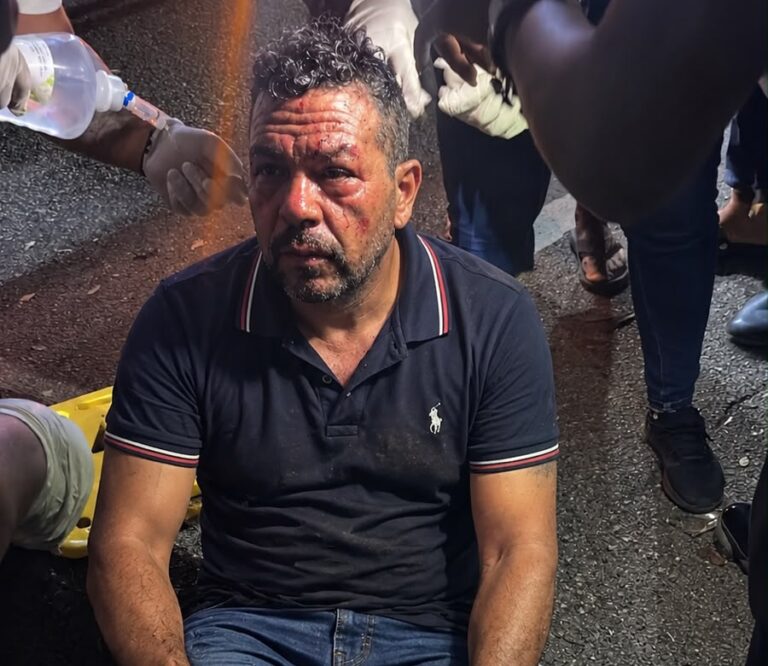 Accidente en Salcedo deja un hombre herido con fracturas en ambas piernas