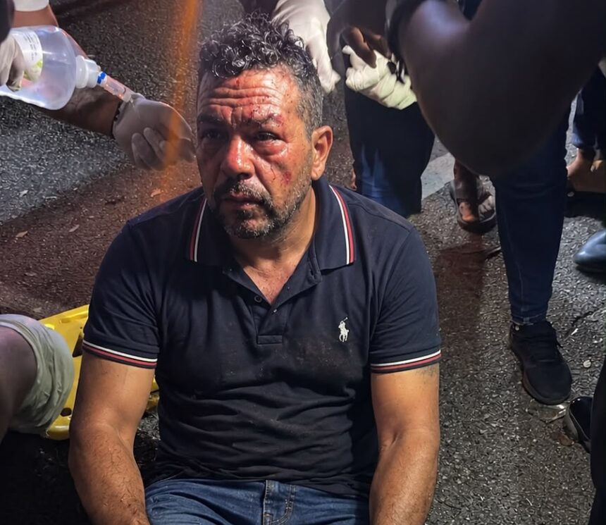 Accidente en Salcedo deja un hombre herido con fracturas en ambas piernas