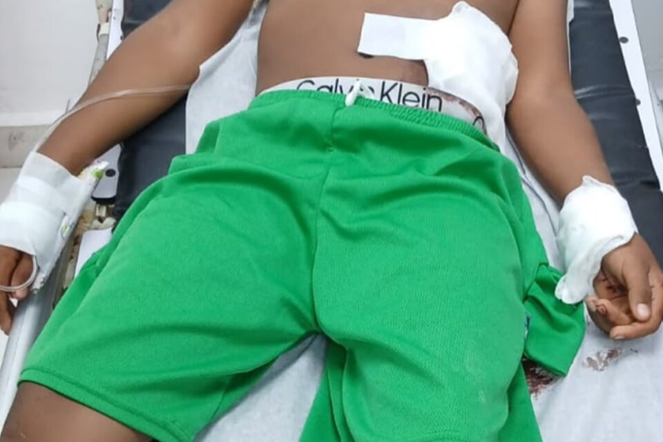 Niño de ocho años resulta herido de bala mientras manipulaba una «chilena» en Barahona