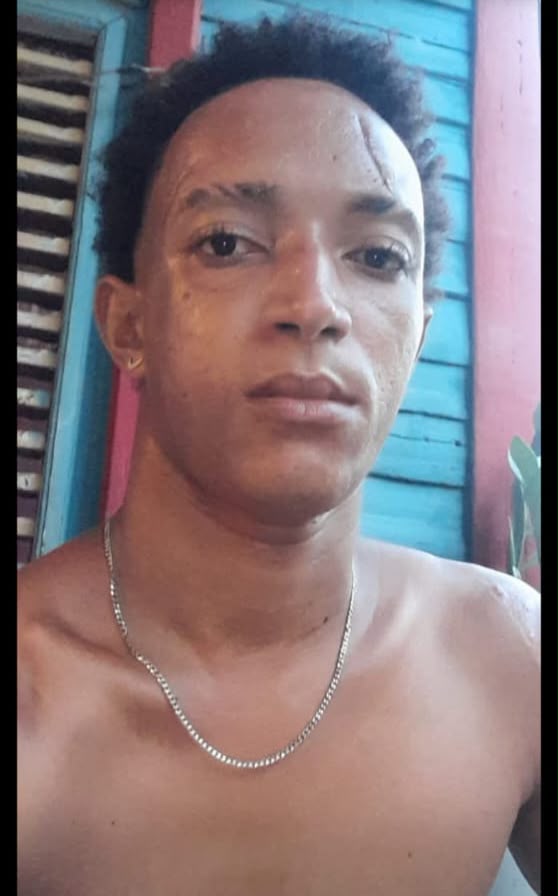 Cuatro personas mueren en accidentes de tránsito ocurridos por separado en Samaná 3 | Noticias de hoy en República Dominicana WhatsApp Image 2026 10 19 at 5.58.07 PM | Noticias de hoy en De Último Minuto