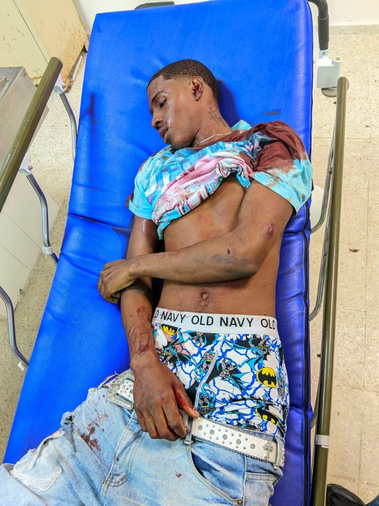 Cuatro personas mueren en accidentes de tránsito ocurridos por separado en Samaná 1 | Noticias de hoy en República Dominicana WhatsApp Image 2026 10 19 at 5.58.17 PM | Noticias de hoy en De Último Minuto