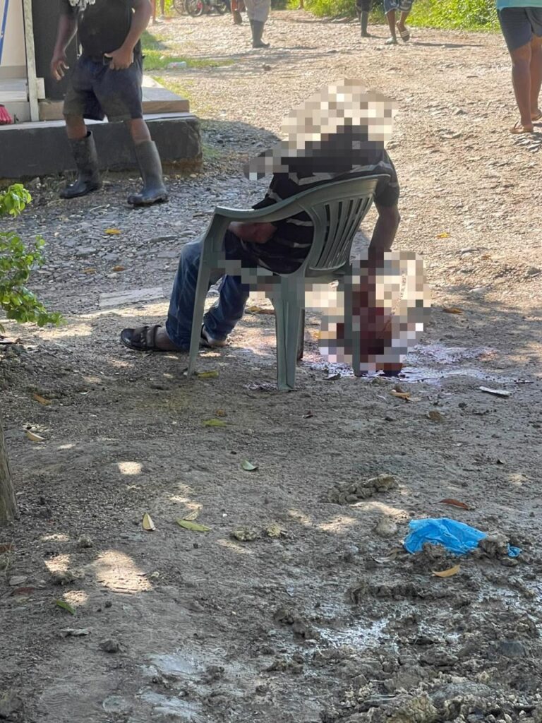 Policía apresa a hombre acusado de decapitar a otro en Villa Mella 1 | Noticias de hoy en República Dominicana WhatsApp Image 2026 10 23 at 1.11.39 PM | Noticias de hoy en De Último Minuto