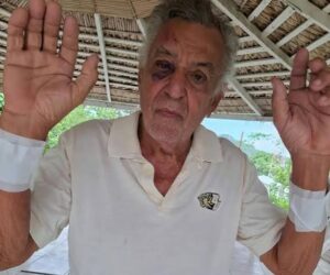 Empresario tabaquero de Altamira es brutalmente golpeado durante asalto en su residencia
