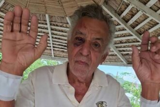 Empresario tabaquero de Altamira es brutalmente golpeado durante asalto en su residencia